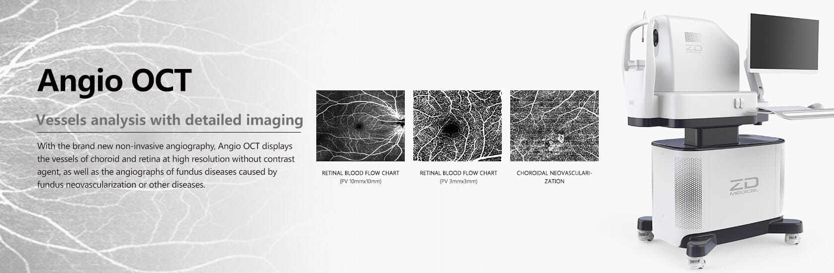 Optical Coherence Tomography Angiography