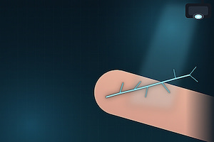Why Are First Sticks So Hard on Children and Elderly Patients — and Can a Vein Finder Help?