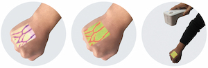 What are the benefits of the new generation vein finding system？