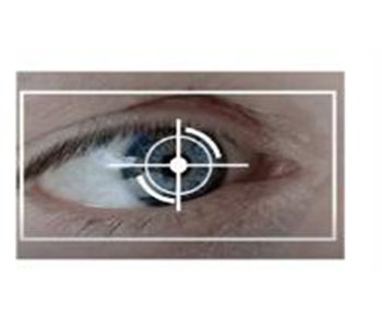 What are the working principles and characteristics of Optical Coherence Tomography？