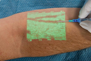Overcoming Venipuncture Challenges: Choosing the Right Vein Finder for Dark Skin Tones