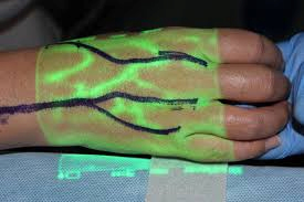 What are the relevant foreign research and technological advancements regarding Vein Finder?