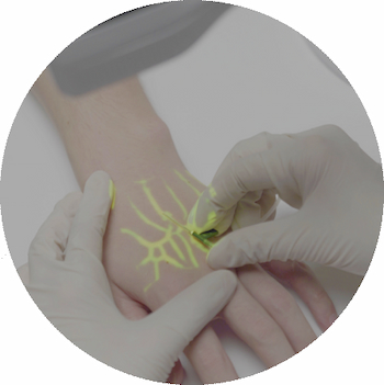 New Generation Vein Finder System Advantages and development prospects