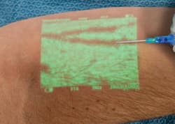  How deep can a medical vein finder see?