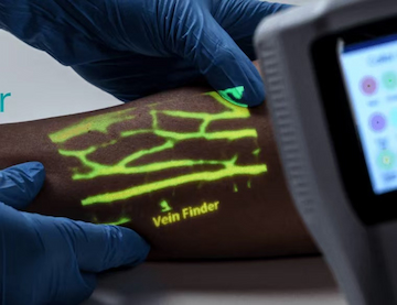 Vein finder maintenance guide：Lifespan, calibration, and durability.