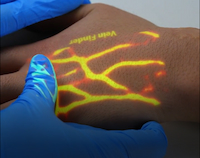 Clinical Applications of Vein Finder