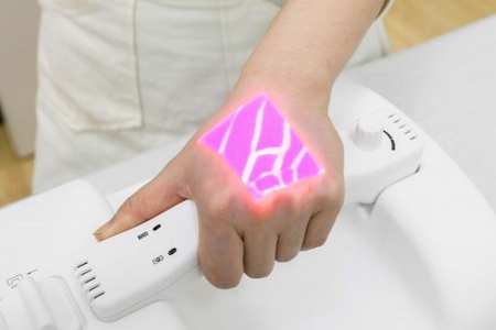 What are the benefits of using a Vein finder?