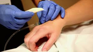 How to evaluate clinical effectiveness before buying a vein finder?