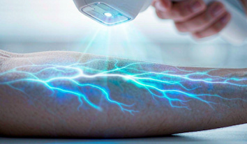 Vein Finder Buyer's Guide: Reducing Difficult Venous Access Costs | ZD Medical