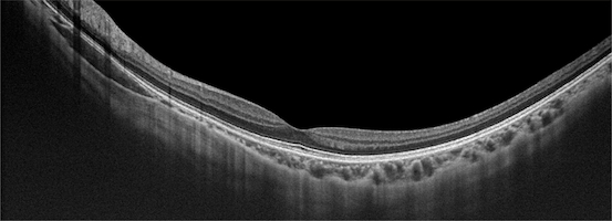 What are the features and benefits of Optical Coherence Tomography Luminor-D60?