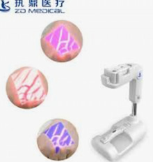 What are the four key points that Vein Finder must pay attention to?