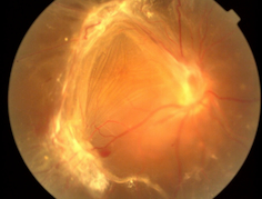 Holding hands and looking at the eyes to help with diagnosis | Suddenly 