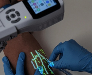 It Literally Lets You See the Veins! — How ZD Medical Vein Finders Redefine IV Access