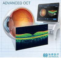 How ZD Medical High-Resolution OCT Platforms Are Revolutionizing Early Ophthalmic Diagnostics