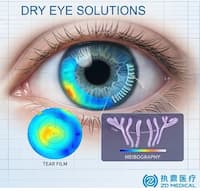 Advancing Ocular Surface Care with the ZD Medical Integrated Dry Eye Solution