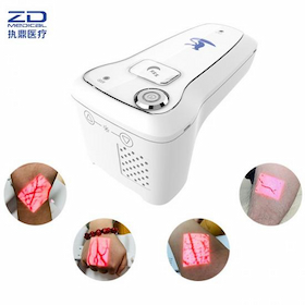 What is the success rate of the vein finder?